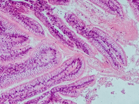 blackbird small intestine cross section under the microscope showing intestinal villi and lumen - optical microscope x400 magnification