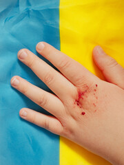 Wounded Hand on the Ukrainian flag