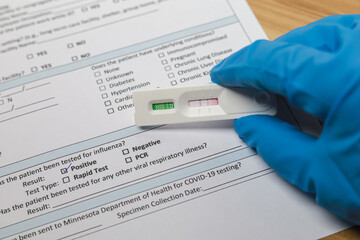 Doctor holding Positive test result coronavirus by using rapid test device for COVID-19 virus, novel coronavirus 2019 found in Wuhan, China