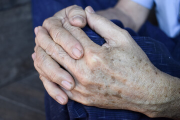 Clasped hands of Asian man. Concept of rheumatoid arthritis, osteoarthritis or joint pain.