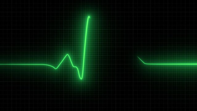 EKG. heart rate monitor. Heart beat pulse in green - cardiology. Looped animation