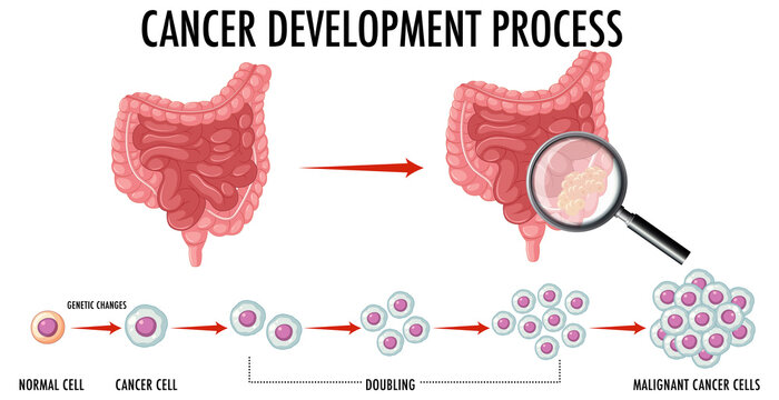 Diagram showing cancer development process
