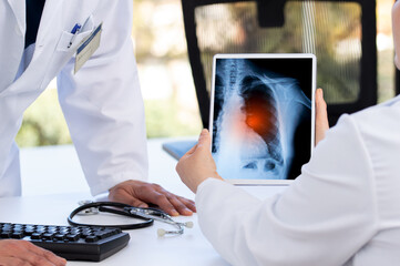 Radiology and medicine concept. doctor explaining the results of scan lung on digital tablet screen...