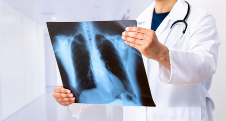 Lung Cancer or Pneumonia. Doctor check up x-ray image have problem lung tumor of patient or long...
