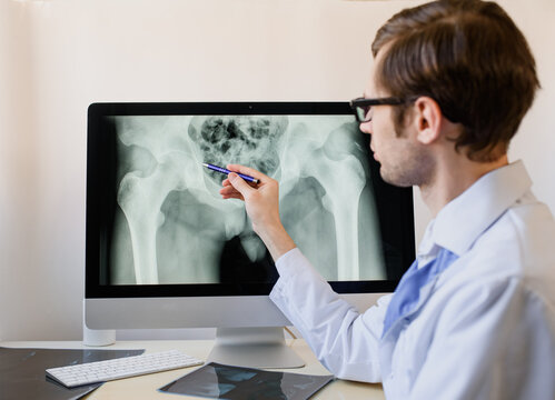 radiologist analyzing a digital pelvic bones x ray on a computer.