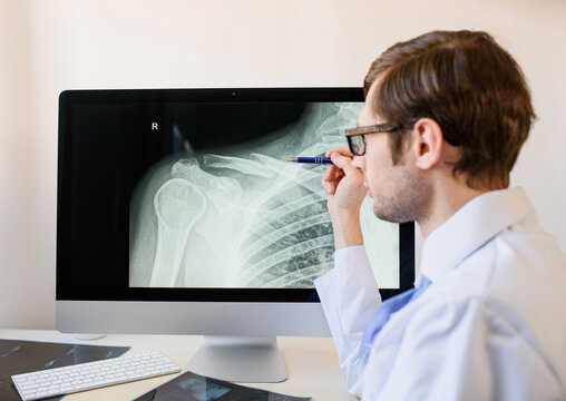 radiologist analyzing a patient x ray with a clavicle fracture.