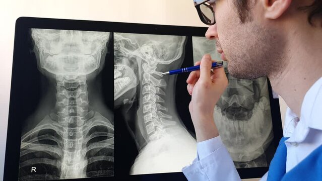 Doctor radiologist analysing a cervical spine x-ray of a patient with spinal chronic pain.