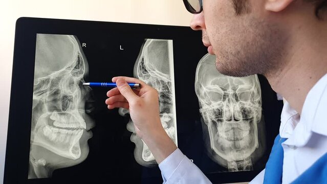 Forensic radiologist doctor analysing a nasal bone fracture x ray after.