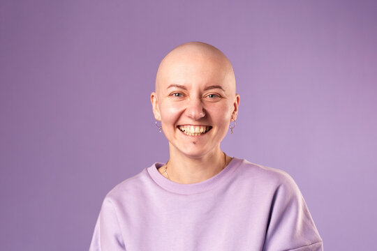 Young Woman Suffering From Cancer Laugh Smile Feel Positive About Future Recovery. Millennial Female With Shaved Head