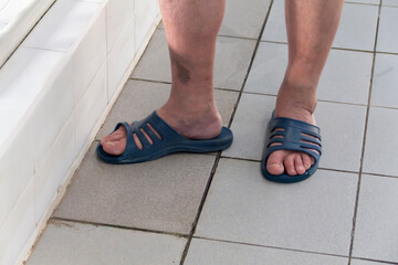Sore legs of an elderly pensioner in blue slippers.
