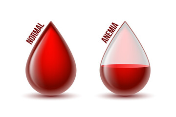 Anemia and Hemophilia icon. Drop shapes with blood level. Vector illustration - 494572302