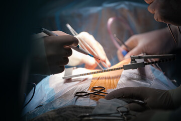 Closeup of professional doctor hands operating a patient during open heart surgery in surgical...