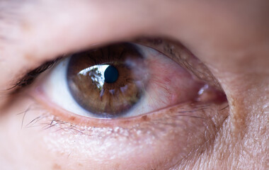 Fototapeta premium Macro shot of the Asian eye, cataract eye