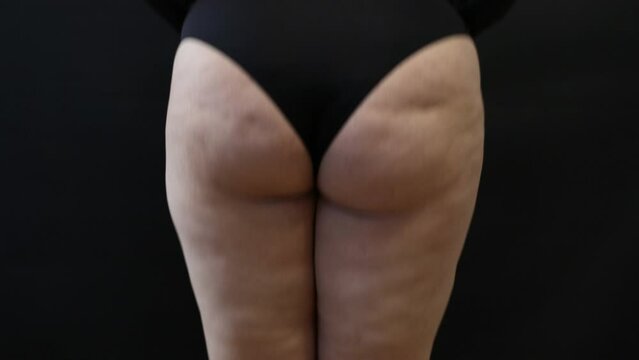 fat woman with cellulite on her legs on a black background