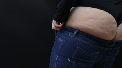 fat woman with cellulite trying to put on jeans on black background