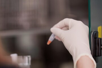 Scientist holding a urine tube for Chlamydia testing antibiotic resistance drug. Selective focus.