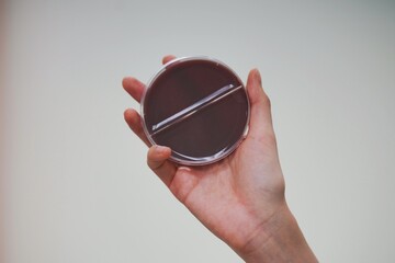 Scientist holding blood agar culture medium plate  for antibiotic resistance test Drug resistant...