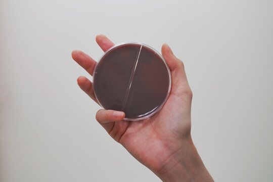 Scientist holding blood agar culture medium plate  for antibiotic resistance test Drug resistant gonorrhea.