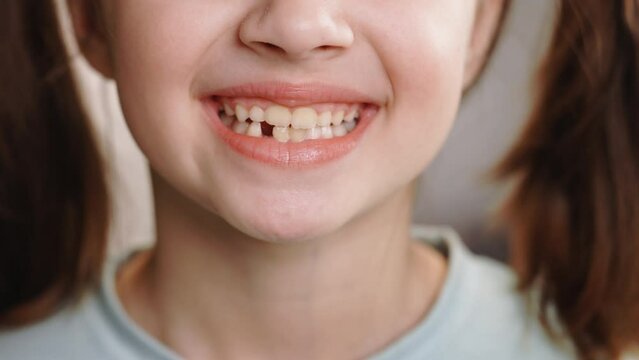 Close up portrait of young caucasian little girl smiling with a toothless smile. Loss of milk teeth, replacement of permanent teeth. Children is dentistry. Show no teeth. Remove the milk tooth.