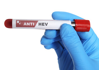 Fototapeta premium Scientist holding tube with blood sample and label Anti HEV on white background, closeup