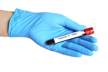 Obraz premium Scientist holding tube with blood sample and label Hepatitis C Test on white background, closeup