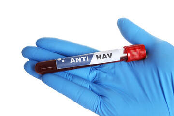 Obraz premium Scientist holding tube with blood sample and label Anti HAV on white background, closeup
