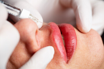 Young lady getting injections for bigger, fuller lips. The woman in the beauty salon. Plastic surgery clinic.
