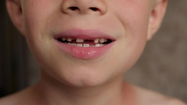A close-up of a little boy shows his fallen out baby teeth. Change of teeth in children.