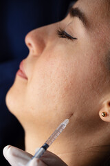Injection to the face in the chin area. aesthetics, medicine concept. youth injections.
