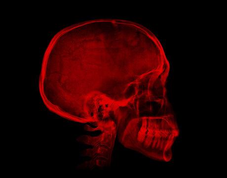 Human skull. Red X-ray image on black background