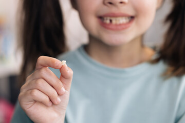 Little Girl Loosing her baby teeth. Little girl with milk temporary tooth. Happy child holding her...