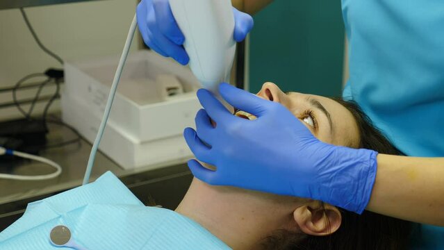 Modern dental clinic concept. Orthodontist using 3D intraoral scanner for scanning patient teeth. Manual teeth scanner. New technologies in dentistry. Healthcare And Stomatology. 4 k video