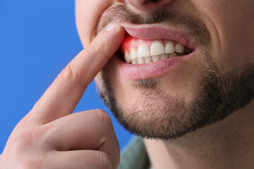 Man with gum inflammation on blue background, closeup