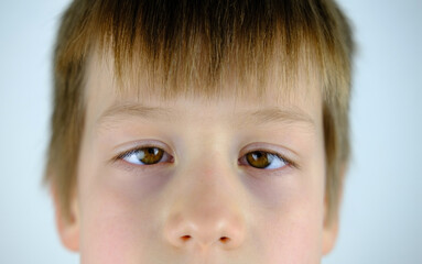 close-up of part of child's face, brown eyes of boy 8-10 years old brown eyes look up, little...