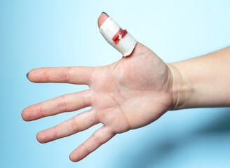 Oopen palm of a human hand and an injured bandaged thumb. 