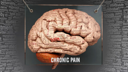 Chronic pain anatomy - its causes and effects projected on a human brain revealing Chronic pain complexity and relation to human mind. Concept art, 3d illustration