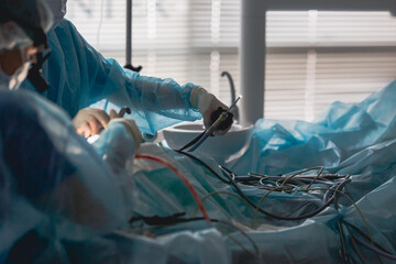 Surgeon in the operating room performing an operation on a man working with clamps in the stomach
