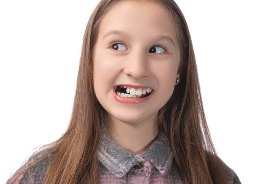 A cheerful cute girl with an orthodontic appliance makes faces on a white background. The concept of teeth alignment in childhood. Studio photo on a white background.