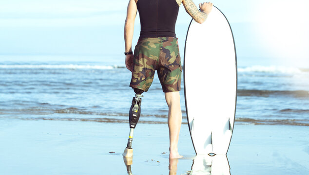 Caucasian surfer man with an artificial leg, looking at the sea and holding a surfboard, Concept of overcoming,