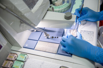 Medical scientists are preparing pathological biopsy slides for pathologists to diagnose the results.