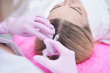 Obraz na płótnie Canvas Female client getting injection into scalp during mesotherapy
