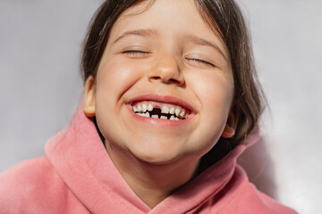 portrait of a beautiful emotional caucasian girl in a pink sweatshirt who lost her first tooth. Close-up of a child with a smile and joy