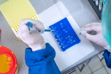 Medical lab scientists in laboratory using Air displacement micro pipettes filling a colorless...