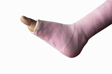 leg fracture plaster cast isolated on white background