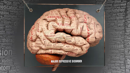 Major depressive disorder anatomy - its causes and effects projected on a human brain revealing Major depressive disorder complexity and relation to human mind. Concept art, 3d illustration - obrazy, fototapety, plakaty