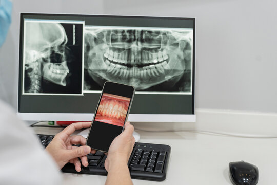 Dentist with mobile phone examining x-ray image on computer at dental clinic