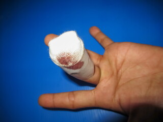 wound on fingers and red blood on the top of finger