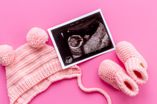 Newborn booties and prenatal ultrasound screening of unborn baby
