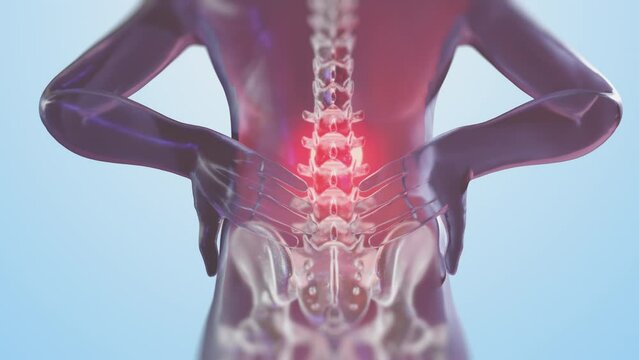 VFX Back Pain Virtual Reality Presentation Render. Animated Person Experiencing Discomfort in a Result of Spine Trauma or Arthritis. Schematic Medical Visualization.
