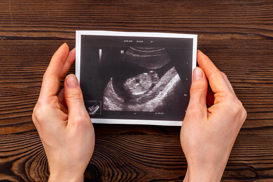Womans hands holding ultrasound scan of unborn baby. Pregnancy background